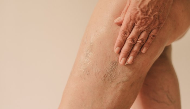 can-you-reverse-crepey-skin?-look-for-these-ingredients