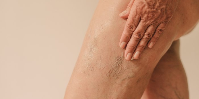 can-you-reverse-crepey-skin?-look-for-these-ingredients can-you-reverse-crepey-skin?-look-for-these-ingredients