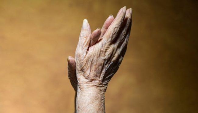 what-is-“crepey-skin”-&-how-to-actually-tighten-it,-from-a-derm