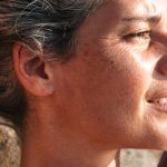 This Oft-Overlooked Sign May Help Diagnose Skin Cancer, Study Finds this-oft-overlooked-sign-may-help-diagnose-skin-cancer,-study-finds